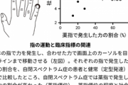 【画像】東大「自閉症の人は”薬指”がこうなってる」