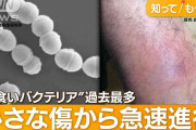 “人食いバクテリア”過去最多　致死率3割…「死を覚悟」片足失った男性　感染経路は