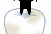 虫歯ずっと放置した結果ｗｗｗｗ