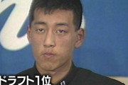 ナベＱ毛髪流出の歴史