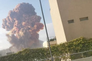 【悲報】レバノンの大爆発をまともにくらった結果wwwwwwwwwwwwwwwwwwwww