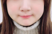 【画像】親知らずを4本同時に抜いてしまった女の子ｗｗｗｗ