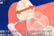 有識者「歯間ブラシは血が出るから止めとけ！」
