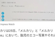 【悲報】「胎児エコー写真」の出品が禁止になったメルカリ、またしてもとんでもない物が売りに出される