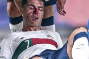 【悲報】クリスティアーノ・ロナウドさん、試合中に殴られる【微閲覧注意】