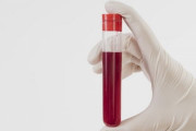 海外「これは凄い助けになりそうだ！」日本の大学が開発した常温で保存可能な人工血液に対する海外の反応