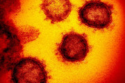 新型コロナウイルス「すでに遺伝子が変異した」人間の体内環境に適応か…中国医師！