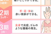 【悲報】梅毒患者が2年連続で1万人超え　昨年より2ヶ月早く到達　なお原因は不明