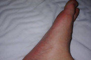 ワイの足、土踏まずという概念がない（※画像あり）