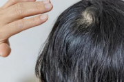 【画像】夫のつむじが数年前から大きくなってて本人も気にしてる。それで「自分でお金出すから増毛したい」って言いだしたんだけど…