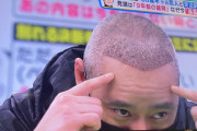 【朗報】いしだ壱成さん、植毛してフサフサになる