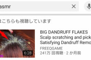 YouTubeでフケ処理の動画見たことあるやついる？