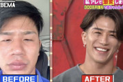 整形費用300万円で“岩田剛典似”に激変した男性登場 “やって良かった整形”告白
