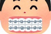 【急募】歯列矯正中の人おるか？