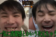 【画像】歯無しイケメン、800万円かけて全部セラミックにした結果ｗｗｗｗｗ