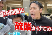 【悲報】大物YouTuber「友達に硫酸かけてみた」 （※画像あり）