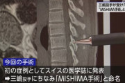 DeNA三嶋投手が受けた国指定難病の手術「MISHIMA手術」と命名