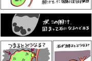 【画像】キミは胆のうを知っているか