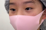 【悲報】小学生女子、遂に整形する時代へ。成長期にやるとか大丈夫なのか…？