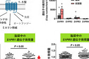 【研究】統合失調症の脳で「特定の脂質」が低下していると判明、新たな治療薬創出に期待