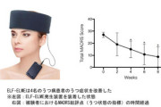 【画像】うつ病の最新の治療法「磁場ヘッドバンド」がヤバすぎる