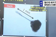 髪の毛が薄いことを気にしてる人に朗報？体外で人工的に髪の毛作成に成功 脱毛症治療など期待