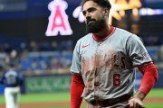 【悲報】エンゼルスのレンドンさん、キャンプ初日に手術で長期離脱決定