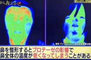 【画像】サーモグラフィーで整形がバレる模様・・・