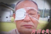 【悲報】吉田製作所さん、右目の視界を失う