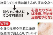秋田で梅毒感染者急増　昨年の2倍以上　夫婦、恋人間で拡大懸念