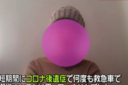 コロナ後遺症で大量の『脱毛』に苦しむ女子大生の報道　「大学院退学も考えている。就職も難しい。人生が変わってしまった」