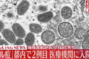 「サル痘」国内2例目が確認される