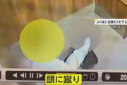 看護師が患者に殴る蹴るの暴行 病院長は警察や自治体に報告せず