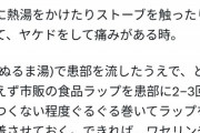 【悲報】X民「火傷したら患部にラップ！」医者「絶対にやめろ！重症化したり死ぬぞ！！！」