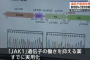 アトピー・脱毛症に光明か 新しい遺伝子変異を発見、治療薬の効果も確認