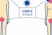 女性の性病「陽性」結果を夫同席の場で伝えた医師、賠償金44万円支払いへ