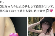 【画像】女の子「豊胸手術して人生が変わった。マジでおすすめ」