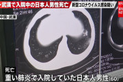 【速報】武漢で入院中の日本人男性が死亡　新型コロナの疑い