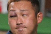 【悲報】 中田翔さん、バット破壊で右目を怪我