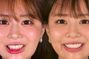 あたシコ声優・井口裕香さん、歯が総セラミックに超絶進化！！
