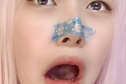【衝撃】物申す系YouTuberへライザー、重度の顎変形症だった…