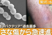 【警告】恐怖の“人食いバクテリア” 東京で広まる…患者「足を切断した」