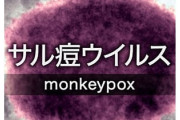 国内初のサル痘　ヨーロッパから帰国後の濃厚接触者が特定される