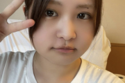 【元乃木坂46】こんなに腫れるのか！！？？伊藤かりん、手術後の衝撃写真を公開wwwwww『加工してない？？』