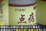 【悲報】中国製ほくろ取りクリーム、やべえクリームだった