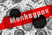 厚生労働省「サル痘の病変は会陰部と肛門と口に集中している」