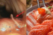 【閲覧注意】韓国人「刺身は危険だ‥」サケの刺身を食べた日本人女性の首から発見された巨大寄生虫がこちら‥　韓国の反応