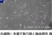 【老化細胞除去薬】順天堂大学のグループ、糖尿病治療薬で老化細胞を取り除く動物実験に成功