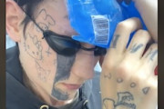 【動画】顔面のTATTOOを死ぬほど後悔して入れ墨除去サロンに通う男ｗｗｗ