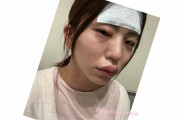 女性格闘家・ぱんちゃん璃奈（27）、異物混入モデルナ接種でまぶたや唇も腫れ呼吸困難に…救急搬送明かす